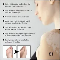 Effectively Remove/  Vitiligo White Spots/  Fades Skin Marks/  Skin Vitiligo Treatment 90 days 10ml (set of 3)-thumb2