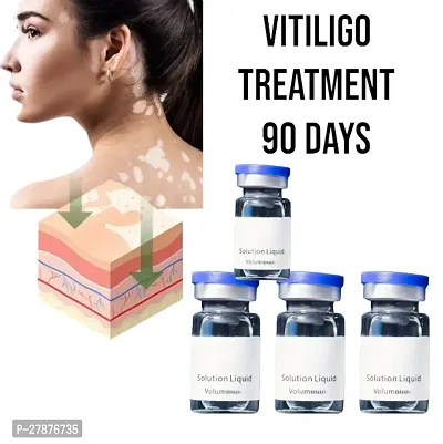White Tag Cream /Treatments Gently Repair Moisturizing Cream /Reduces White Spots/ Vitiligo Ointment To Remove/ 90 days treatment/10ml (set of 4)