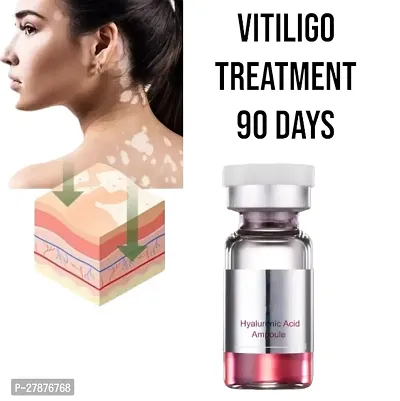 White Spot Ointment/ Moisturing Disease Treatments /Tag Remove Serum Cream Repair/ Vitiligo treatment 90 days 5ml (set of 1)