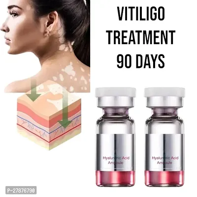 Vitiligo treatment cream/ Vitiligo relief spray/ Skin treatment lamp /White Spot Removal/ vitiligo Treatment 90 days 10ml (set of 2)-thumb0