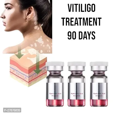 Vitiligo Ointment Remove /Ringworm White Spot Removal Cream/ Herbal Vitiligo gel cream/ 90 days treatment/10ml (set of 3)-thumb0