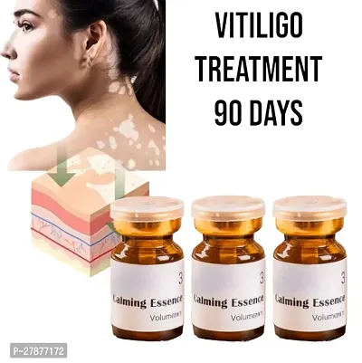 Repair Leukoplakia/  Vitiligo White Spot Cream/ Vitiligo Repair/ Whole Body Skin White Spot Elimination /Products Cream/ 90 days treatment/ 10ml (set of 3)
