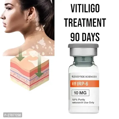 Repair Leukoplakia Vitiligo White Spot Cream Skin Care Vitiligo relief spray/ 5ML (SET OF 1)-thumb0