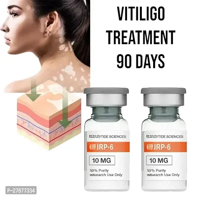 Vitiligo medicine /vitiligo removal cream / vitiligo treatment/  vitiligo ointment 90 days treatment / 10ml (set of 2)