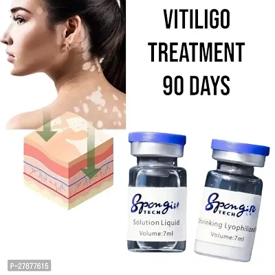 Vitiligo Cream/ White Spot REMOVE Cream/ Vitiligo Eliminate Vitiligo Cream/ Herbal Extract/  Vitiligo Ointment Remove/ 10ml (set of 2)-thumb0