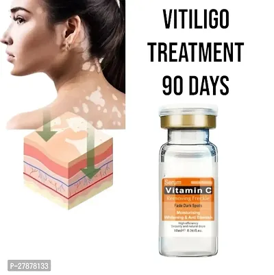 Vitiligo Ointment To Remove /Ringworm Herbal CREAM/ Reduces White Spots Fades Skin Marks Skin Vitiligo/ 5ml (set of 1)-thumb0