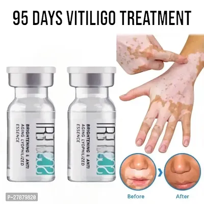 Vitiligo treatment cream/  Skin Vitiligo Care For Adults/ Vitiligo derma relief 95 DAYS GEL/ 95 days vitiligo treatment/ 10ml (set of 2)