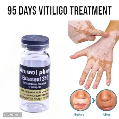 Effectively Remove Cream/ Vitiligo Ointment Remove Ringworm/  White Spot/  Vitiligo Cream /Leukoplakia Treatment/ 95 days 5ml (set of 1)