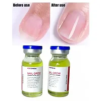 Repairs Cuticle  Nail Overnight, Stimulates Nail Growth, For Damaged Skin  Thin Nails - 100% Natural/ 10ml (set of 2)-thumb2