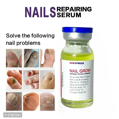 Nail Fungus Oil | Healthy Nail Oil | Herbal Essential Oil | Anti-Fungal | Natural Effective Nail Relief Oil | Cuticle oil | Fast-Acting Infection Treatment/ 5ml (set of 1)-thumb2