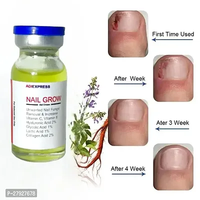 Nail treatment fungus / Nail vitamins medicine for nail fungus / Nail vitamins for stronger nails/ 5ML (set of 1)-thumb0