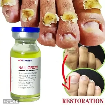 Nail Repair Growth/ Serum/Nail Growth Oil /Nail Cuticle Oil/ Nail Cuticle Cream/ nail fungus, nail care / 5ML (SET OF 1)-thumb0