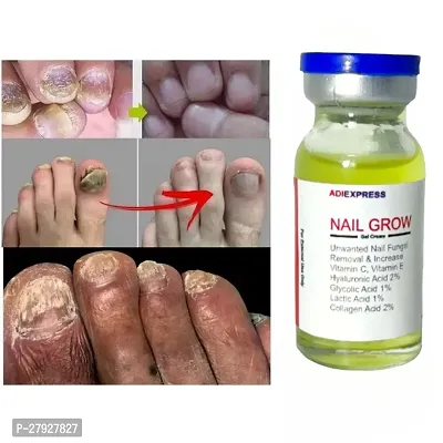 Nail Repair Growth/ Serum/Nail Growth Oil /Nail Cuticle Oil/ Nail Cuticle Cream/ nail fungus, nail care / 5ML (SET OF 1)-thumb5