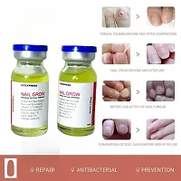 Nail Repair Treatments Cream Anti Remove Nail Onychomycosis Paronychia Promote Nail Growth Brighten Nail Foot Cream/ 10ml (set of 2)-thumb3