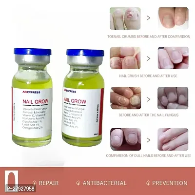 Nail Repair Treatments Cream Anti Remove Nail Onychomycosis Paronychia Promote Nail Growth Brighten Nail Foot Cream/ 10ml (set of 2)-thumb4
