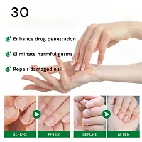 100% Natural Profesional Serum/ For Nail Strong/ Supple and Shaped /Nail Care Serum/ nail strengthener/ nail fungal infection cream/ 10ml (set of 2)-thumb3