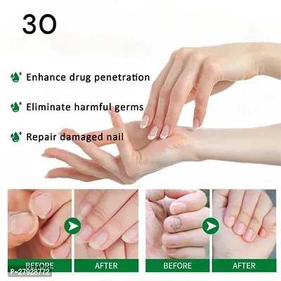 100% Natural Profesional Serum/ For Nail Strong/ Supple and Shaped /Nail Care Serum/ nail strengthener/ nail fungal infection cream/ 10ml (set of 2)-thumb4