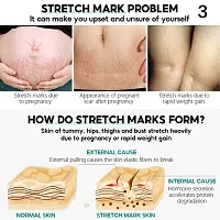 Stretch Marks for Women| Natural Stretch Mark Oil  and Natural Body Butter Stretch Marks Cream for Pregnancy/ 5ml (set of 1)-thumb3