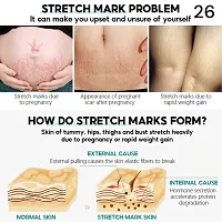 Stretch Mark Cream, Removes Pregnancy stretch marks, Scar removal and Moisturizing Cream, Stretch mark remover cream/ 5ml (set of 1)-thumb2