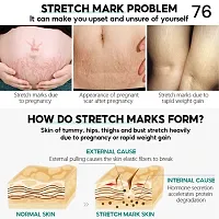 Naturals Stretch Mark Cream for Women- 5ml (set of 1)-thumb1
