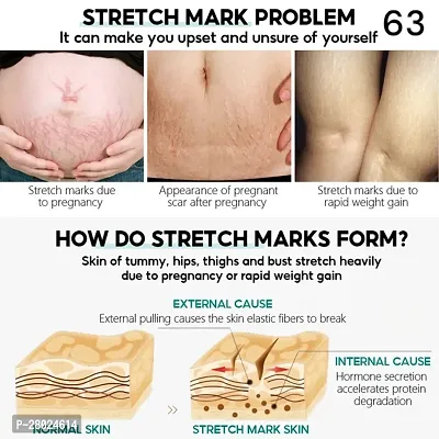 Stretch mark Oil suitable for Stretch Marks | Scar Removal | Uneven Skin Tone | with Sunflower Oil | for All Skin Types/ 10ml (set of 2)-thumb3