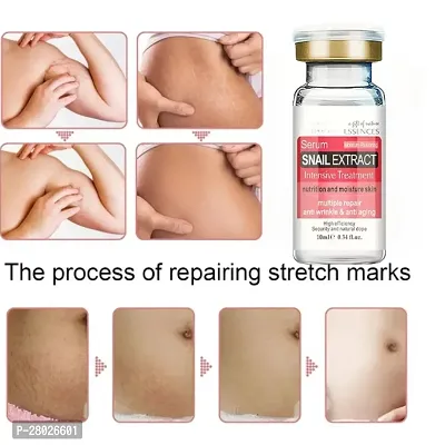 Naturals Stretch Mark Cream Powered with Bio Actives 5ml-thumb0