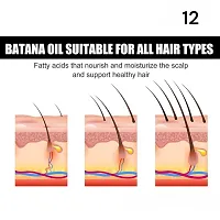 Hair Growth Oil   Vitamin E For Reducing Hair Fall, Strengthens Hair  Breakage | All Hair Types | For Men  Women |5ml (set of 1)-thumb2