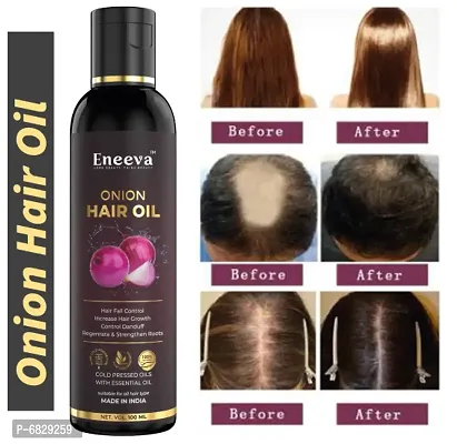 Eneeva Onion oil For Hair Fall Control, Hair Growth  Hair Regrowth- Best Formula For Hair Fall Treatment, Increase the hair Growth, Boost the hair Regrowth, Control Dandruff, Stronger, Thicker and st