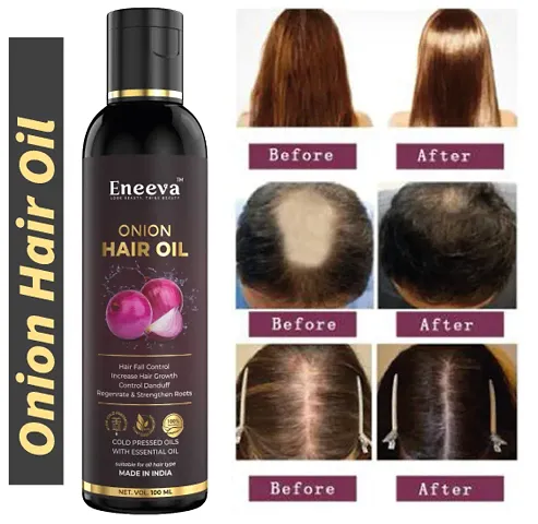 Must Have Hair Oil For Men And Women