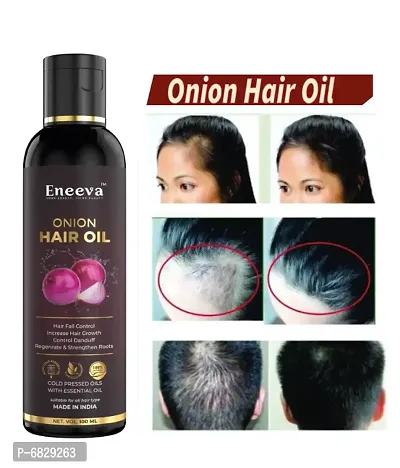 Eneeva Onion oil For Hair Fall Control, Hair Growth  Hair Regrowth- Best Formula For Hair Fall Treatment, Increase the hair Growth, Boost the hair Regrowth, Control Dandruff, Stronger, Thicker and st-thumb0
