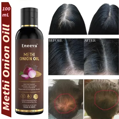 Wild Organic Onion Hair Oil: Buy Wild Organic Onion Hair Oil Online at Best  Price in India | NykaaMan