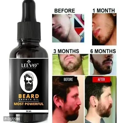 Leevo Beard Oil for Fastest Beard Growth | Mooch Oil | Beard Oil | Mooch tale | Dadi tale | Best Beard Oil of India | Daddi ka Tale | Best Beard Oil | Best Beard Oil of India | Beard Growth Oil.-thumb0