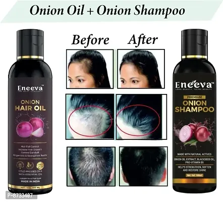 Eneeva Onion Hair Oil and Red Onion Hair Shampoo for Smooth  sliky long Hair Growth Oil | Hair oil for hair growth.