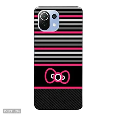 Dugvio? Printed Hard Back Case Cover Compatible for Xiaomi Mi 11 Lite 5G - Pink Bow (Multicolor)-thumb0