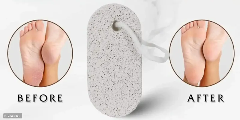 Long Shaped Pumice Stone, White With Rope For Hanging Buy One Get One Free-thumb3