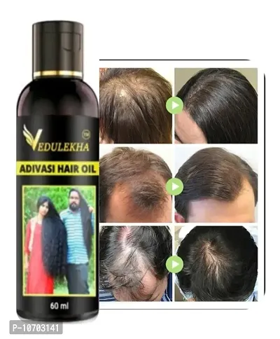 vedushastra Aadivasi Hair growth and hair long oil 5 MAJOR PROBLEMS Long Hair White Hair New Growth Hair Dandruff Removel Hair oil massage comb free 60ml adivasi herbal hair oil , adivashi herbal oil-thumb0