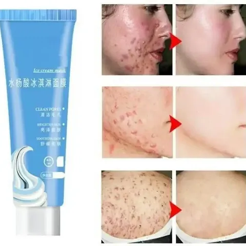 Anti Scar Skin Care Cream For Clear Skin