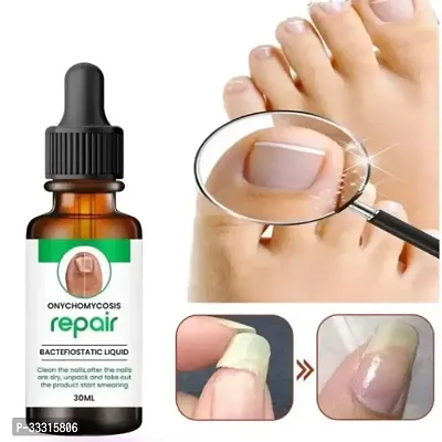 Nail Repair Serum - Strengthen and Restore Nails (30ml)