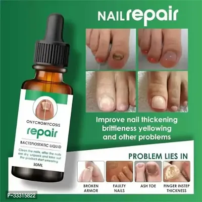 Nail Growth  Repair Formula (30ml)-thumb0