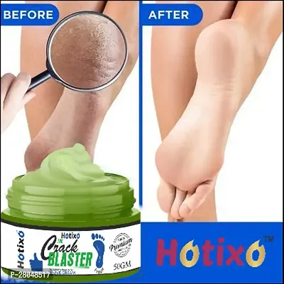 HOTIXO CREACK  BLASTER CREAM PACK OF 01-thumb5