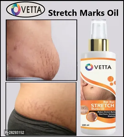 Hotixo Stretch Mark Oil 100ml-thumb4