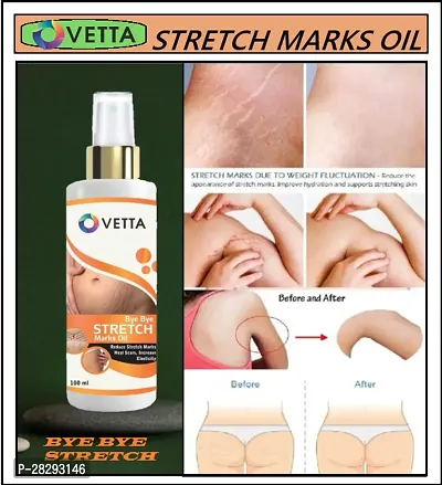 Hotixo Stretch Mark Oil 100ml-thumb2