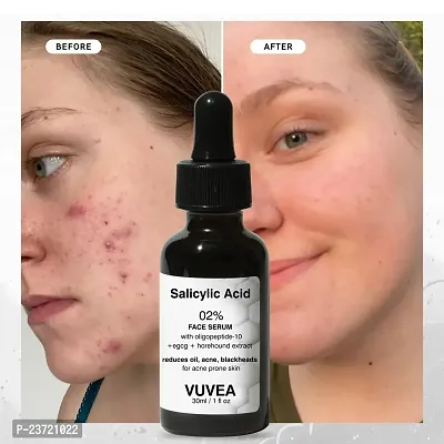 VUVEA Salicylic Acid 02% FACE SERUM with oligopeptide-10 +egcg+horehound extract reduces oil, acne, blackheads for acne prone skin VUVEA 30ml