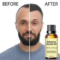 Click to open expanded view Advance Herbal Oil 30 ML | Hair Growth  Hair Fall Control Oil | For Men  Women-thumb2