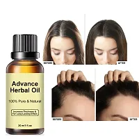 Click to open expanded view Advance Herbal Oil 30 ML | Hair Growth  Hair Fall Control Oil | For Men  Women-thumb3