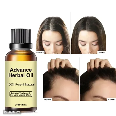 Click to open expanded view Advance Herbal Oil 30 ML | Hair Growth  Hair Fall Control Oil | For Men  Women-thumb4