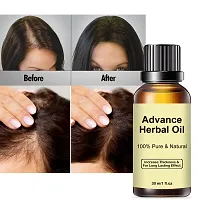 Click to open expanded view Advance Herbal Oil 30 ML | Hair Growth  Hair Fall Control Oil | For Men  Women-thumb1