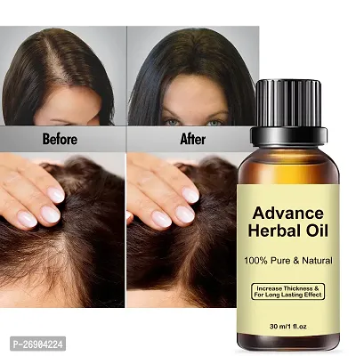 Click to open expanded view Advance Herbal Oil 30 ML | Hair Growth  Hair Fall Control Oil | For Men  Women-thumb2