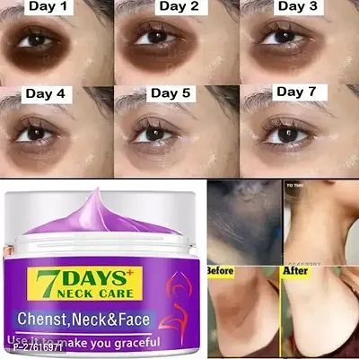 Vuvea Neck Back Elbow Whitening Cream For Remove Black Spots  Warts-50gm Body Creams-thumb4