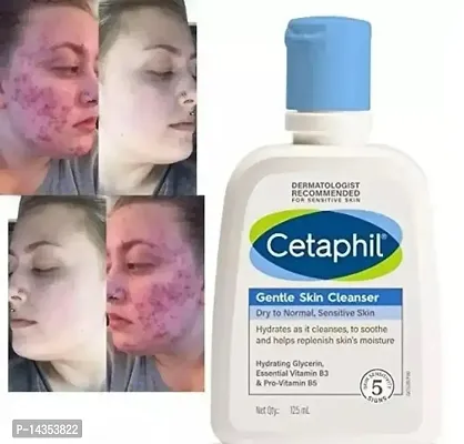 Cetaphil Gentle Skin Cleanser-thumb0
